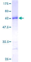 Human EXOSC8 Protein (Recombinant GST)