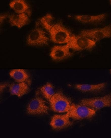 NDRG4 Antibody