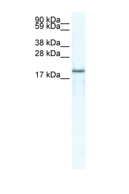 BRAK / CXCL14 Antibody (C-Terminus)