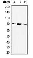SSTR2 Antibody (Internal)