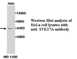 Polyclonal Rabbit anti-Human DRAK1 / STK17A Antibody (C-Terminus, WB)