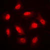PRKAB1 / AMPK Beta 1 Antibody (N-Terminus)