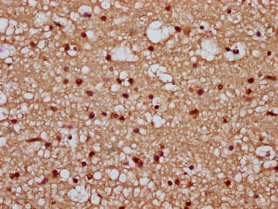 PARP7 / TIPARP Antibody