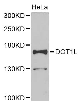 IHC-plus™ Polyclonal Rabbit anti-Human DOT1L / DOT1 Antibody (IHC, WB)