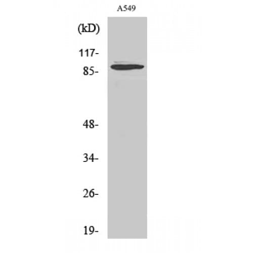 Polyclonal Rabbit anti-Human DAP-5 / EIF4G2 Antibody (10-90 aa, N-terminal, IHC, IF, WB)