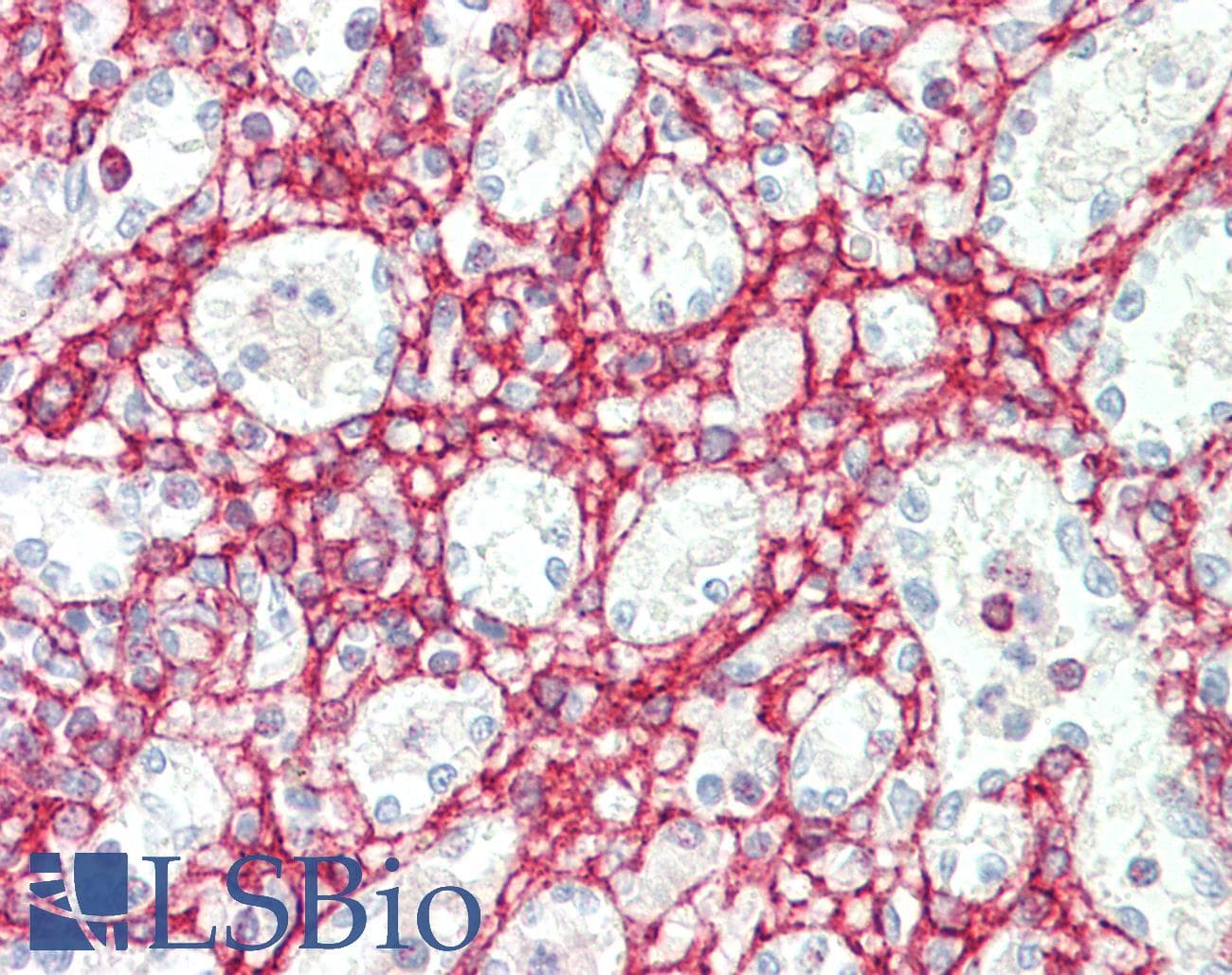 IHC-plus™ CTHRC1 Antibody (clone 1G12)