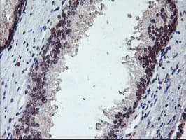 PPP1R15A / GADD34 Antibody (clone OTI3D12)