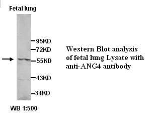Polyclonal Rabbit anti-Human ANGPT4 / Angiopoietin-4 Antibody (Internal, IHC, WB)