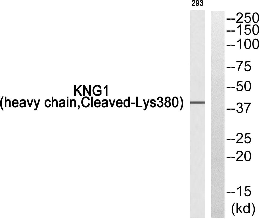 KNG1 / Kininogen / Bradykinin Antibody (heavy chain, Cleaved-Lys380)