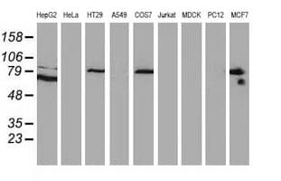 CTNNB1 / Beta Catenin Antibody (clone OTI3C6)
