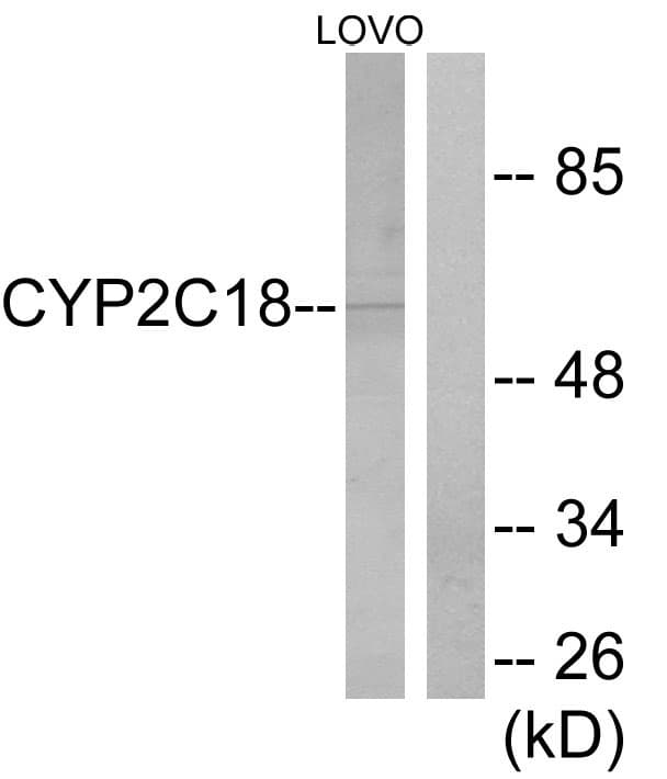 CYP2C8+9+18+19 Antibody (aa111-160)