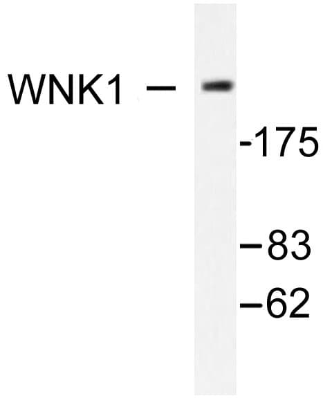Polyclonal Rabbit anti-Human WNK1 Antibody (Tyr52, IHC, WB)
