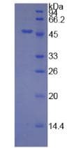 Mouse LTBR Protein (Recombinant His-GST, N-terminus)