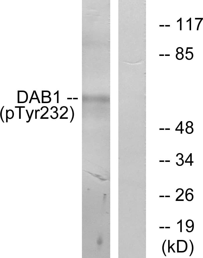 DAB1 Antibody (phospho-Tyr232)
