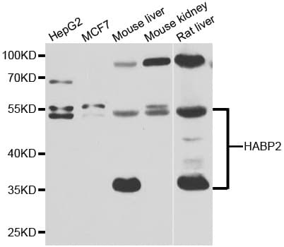 Polyclonal Rabbit anti-Human HABP2 Antibody (IHC, IF, WB)