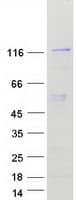 Human NAT10 Protein (Recombinant Myc-DDK (Flag))