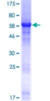 Human LRPB7 / LRRC23 Protein (Recombinant GST)