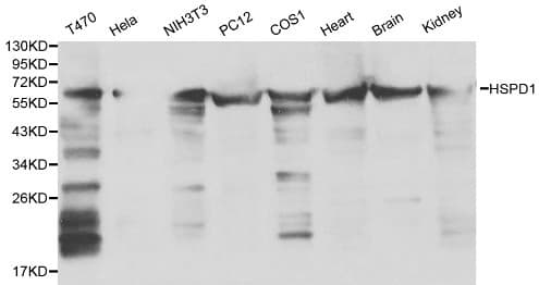 Polyclonal Rabbit anti-Human HSPD1 / HSP60 Antibody (IHC, WB)