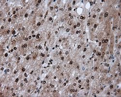 Monoclonal Mouse anti-Human ACLY / ATP Citrate Lyase Antibody (clone 3G8, Carrier-free, IHC, IF, WB)