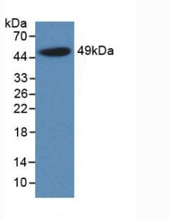 ORM1 / Orosomucoid Antibody
