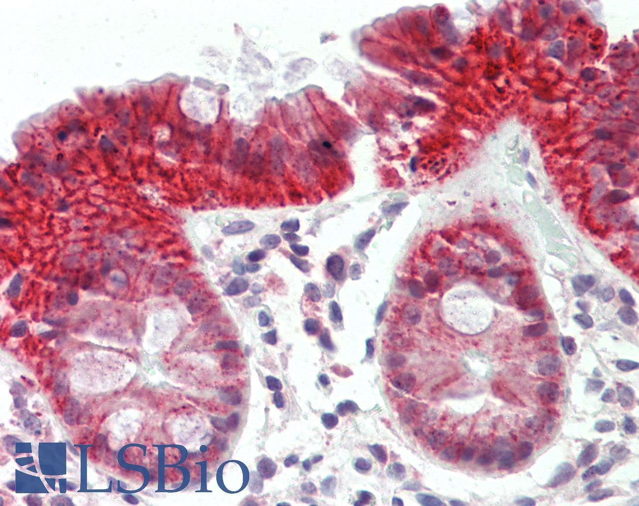 IHC-plus™ Polyclonal Rabbit anti-Human ATG2B Antibody (IHC, IF, WB)