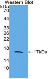 TGFB2 / TGF Beta2 Antibody (aa303-414)