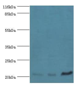 SSSCA1 / p27 Antibody