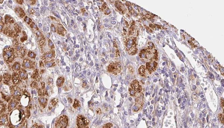 Polyclonal Rabbit anti-Human CHRNG Antibody (IHC, WB)