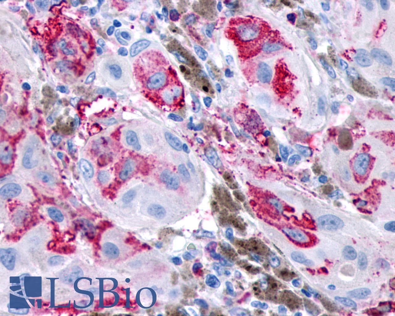 PathPlus™ Polyclonal Rabbit anti-Human GPR161 Antibody (C-Terminus, IHC)