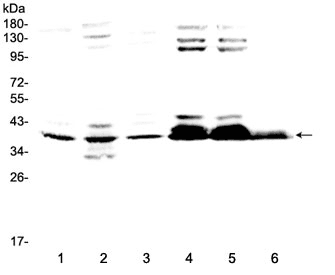 MSI1 / Musashi 1 Antibody
