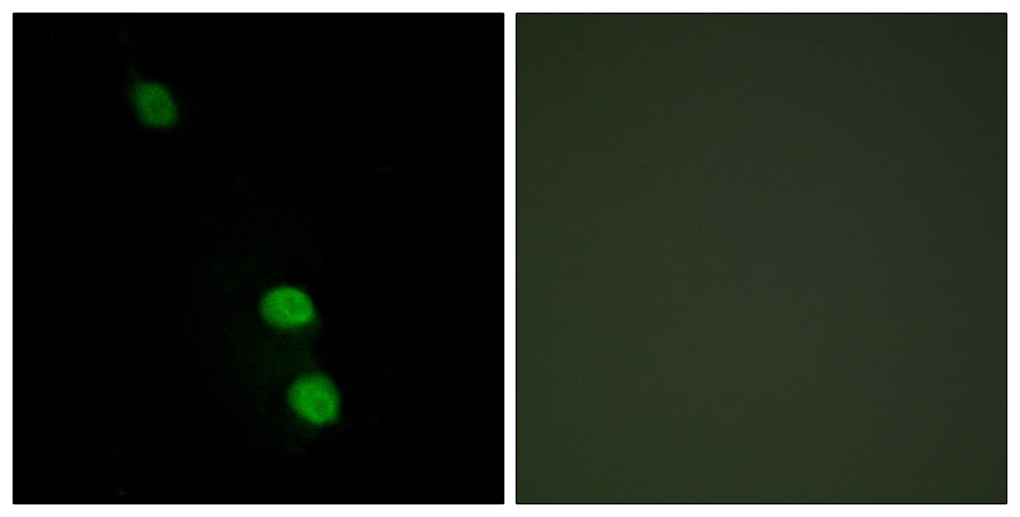 Polyclonal Rabbit anti-Human TEAD2 Antibody (aa71-120, IHC, IF)