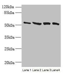 CCDC112 / MBC1 Antibody (Coiled-coil domain)