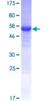 Human KSP32 / MIOX Protein (Recombinant GST)