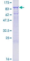 Human MX1 / MX Protein (Recombinant GST)