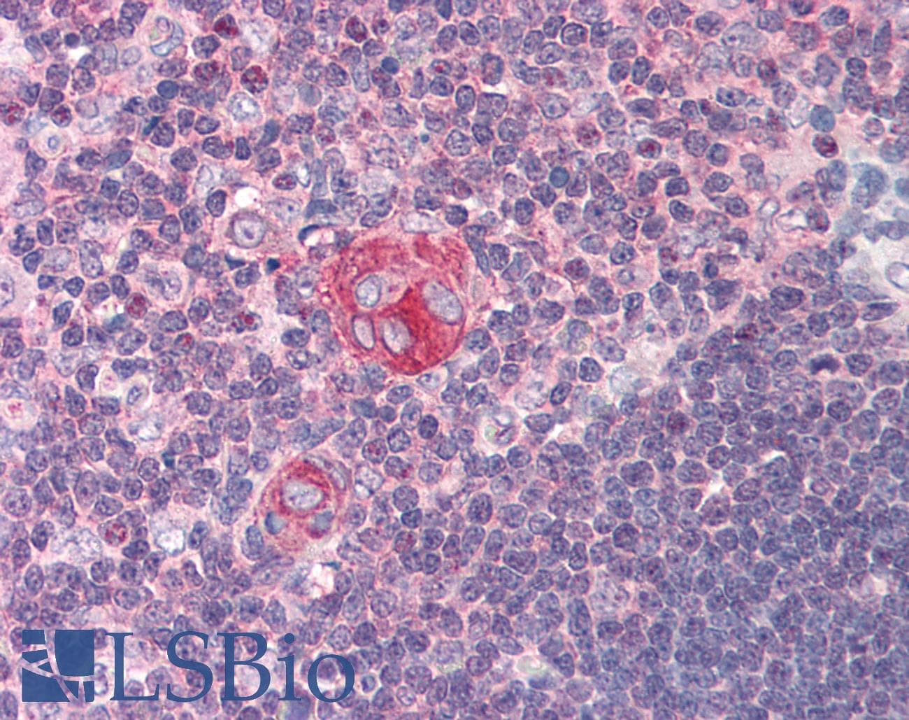 IHC-plus™ NFKB1 / NF-Kappa-B Antibody (N-Terminus)