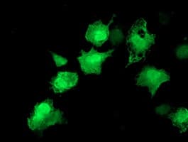 AKT1 Antibody (clone OTI4C11)