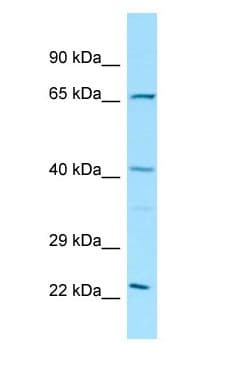 Polyclonal Rabbit anti-Rat ELK3 / NET Antibody (aa51-100, WB)