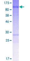 Human CLIP4 / RSNL2 Protein (Recombinant GST)
