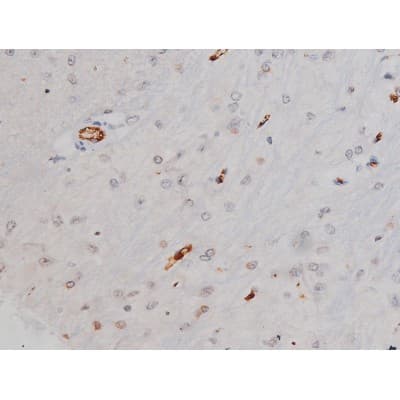 Polyclonal Rabbit anti-Human MAPT / Tau Antibody (phospho-Thr205, IHC, WB)