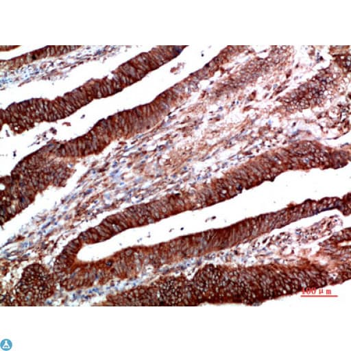 PTEN Antibody