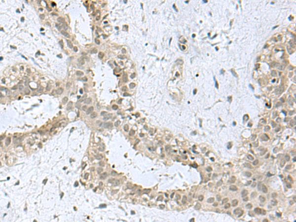 KDM3B / JMJD1B Antibody