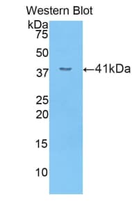 SELE / CD62E / E-selectin Antibody (aa23-140)