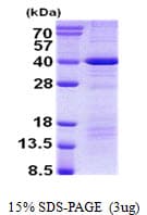 Human DEDD Protein (Recombinant His)