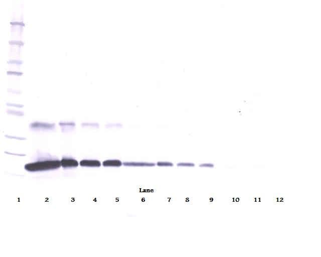 TNFRSF1A / TNFR1 Antibody