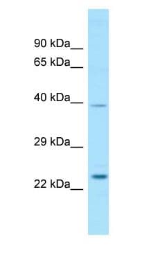 RAB29 / RAB7L1 Antibody (aa104-153)