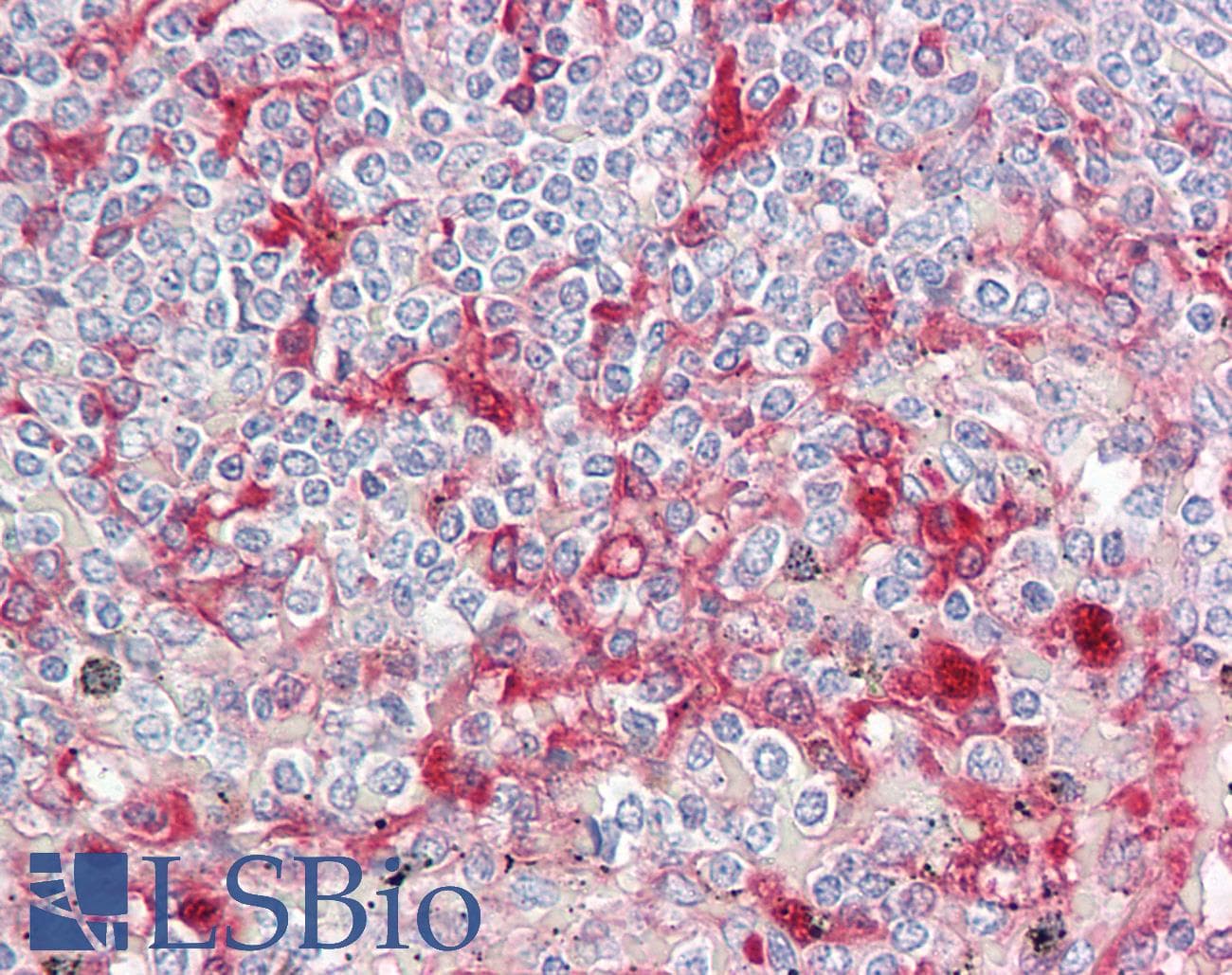 IHC-plus™ ORM1 / Orosomucoid Antibody