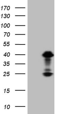 Monoclonal Mouse anti-Human OTX2 Antibody (clone OTI2B3, IHC, WB)