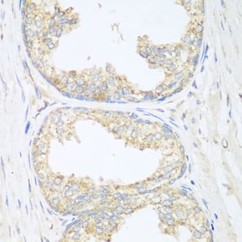 SGCB / SGC / Sarcoglycan Beta Antibody