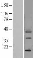 Human SPP1 / Osteopontin Protein (Over-Expression Lysate Myc-DDK (Flag))