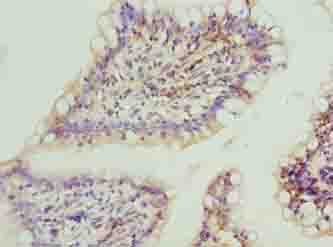 Polyclonal Rabbit anti-Human FAR2 Antibody (IHC)